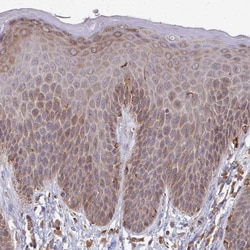iASPP Antibody, Novus Biologicals:Antibodies:Primary Antibodies